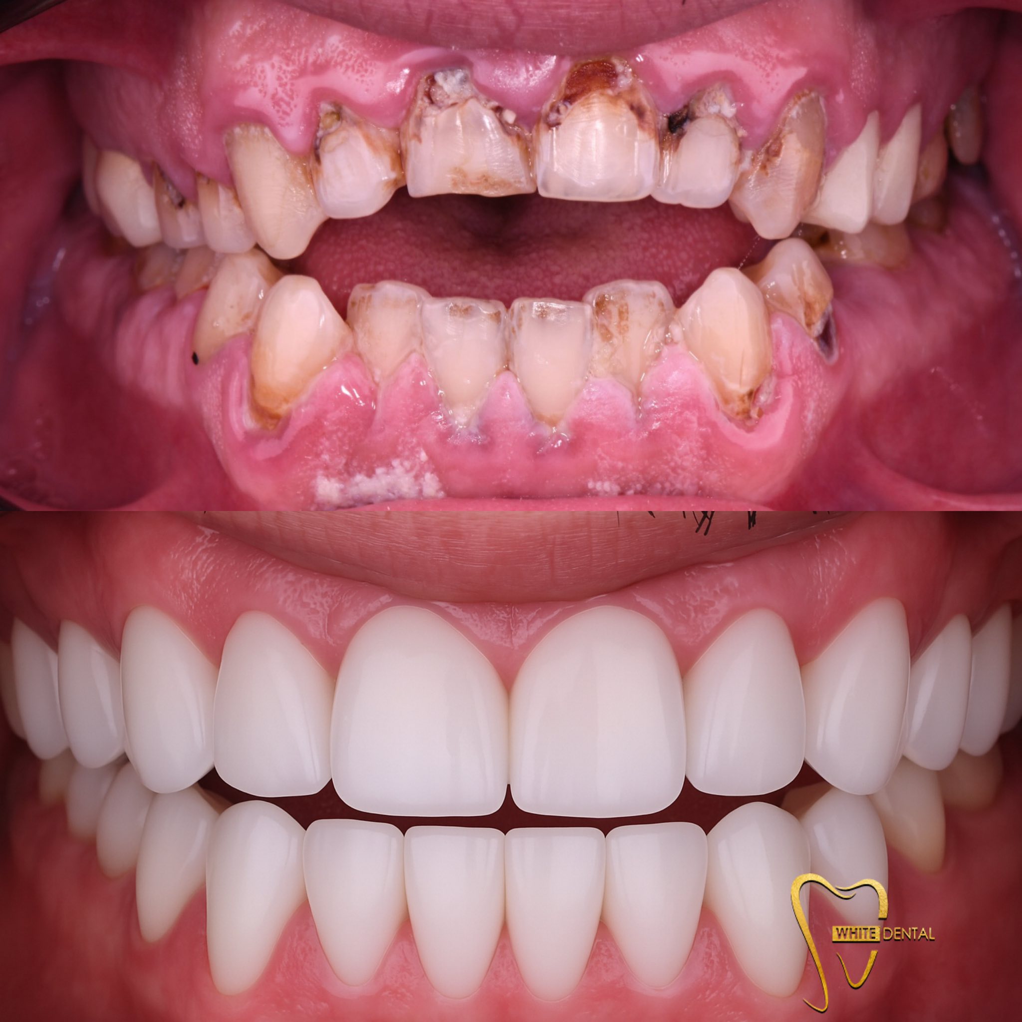 orthodontics case 1
